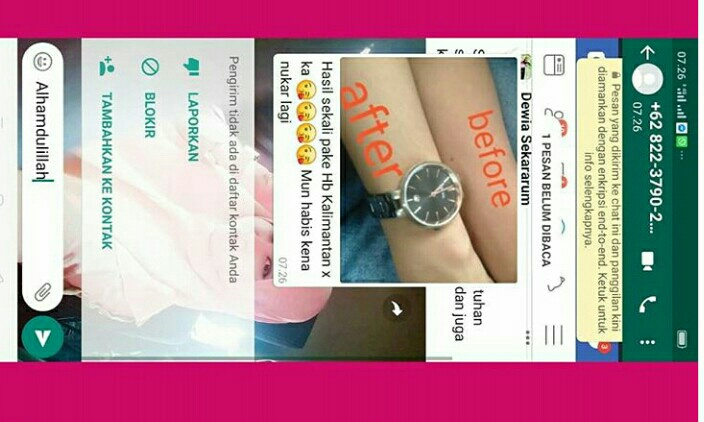 Bio Nerve Banjarmasin 4