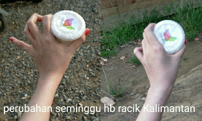 Bio Nerve Banjarmasin 6