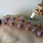 Bekam Kering 2