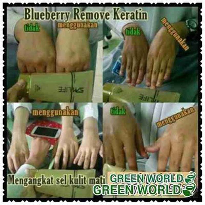 Green World Blueberry Keratin Remove Cream Membuat Kulit Wajah Menjadi 2