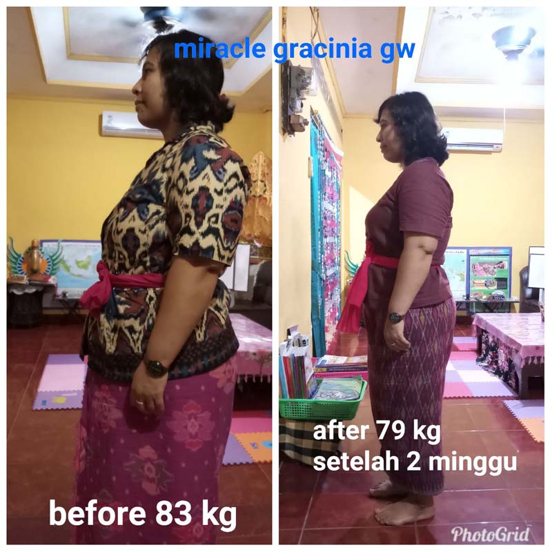 Green World Garcinia Pro Capsule Untuk Membantu Menurunkan Berat Badan 5