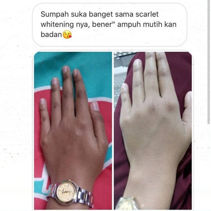Lotion Scarlet Whitening 2