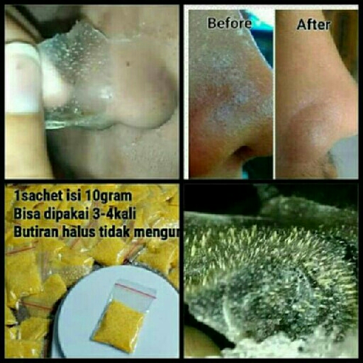 Masker Gelatin Tulang Sapi 3