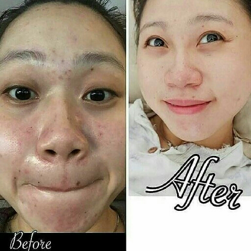 Masker Spirulina Original Tiens 3