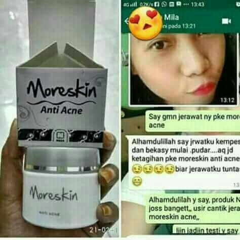 Paket Ampuh Anti Jerawat Nasa 2