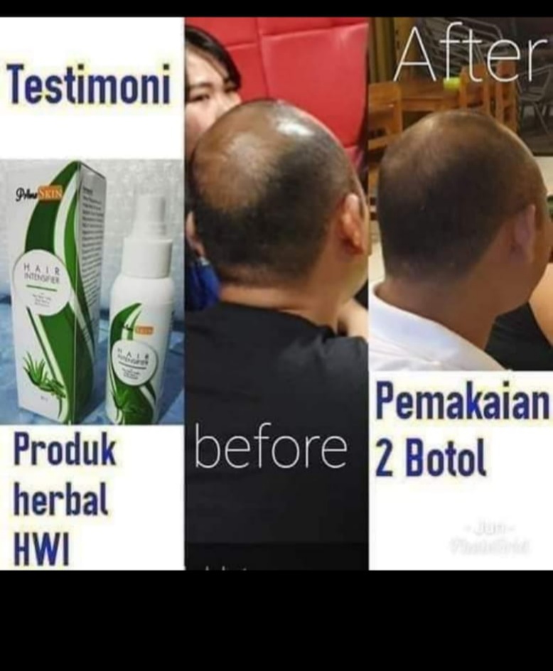 PrimeSkin HAIR Intensifier 2