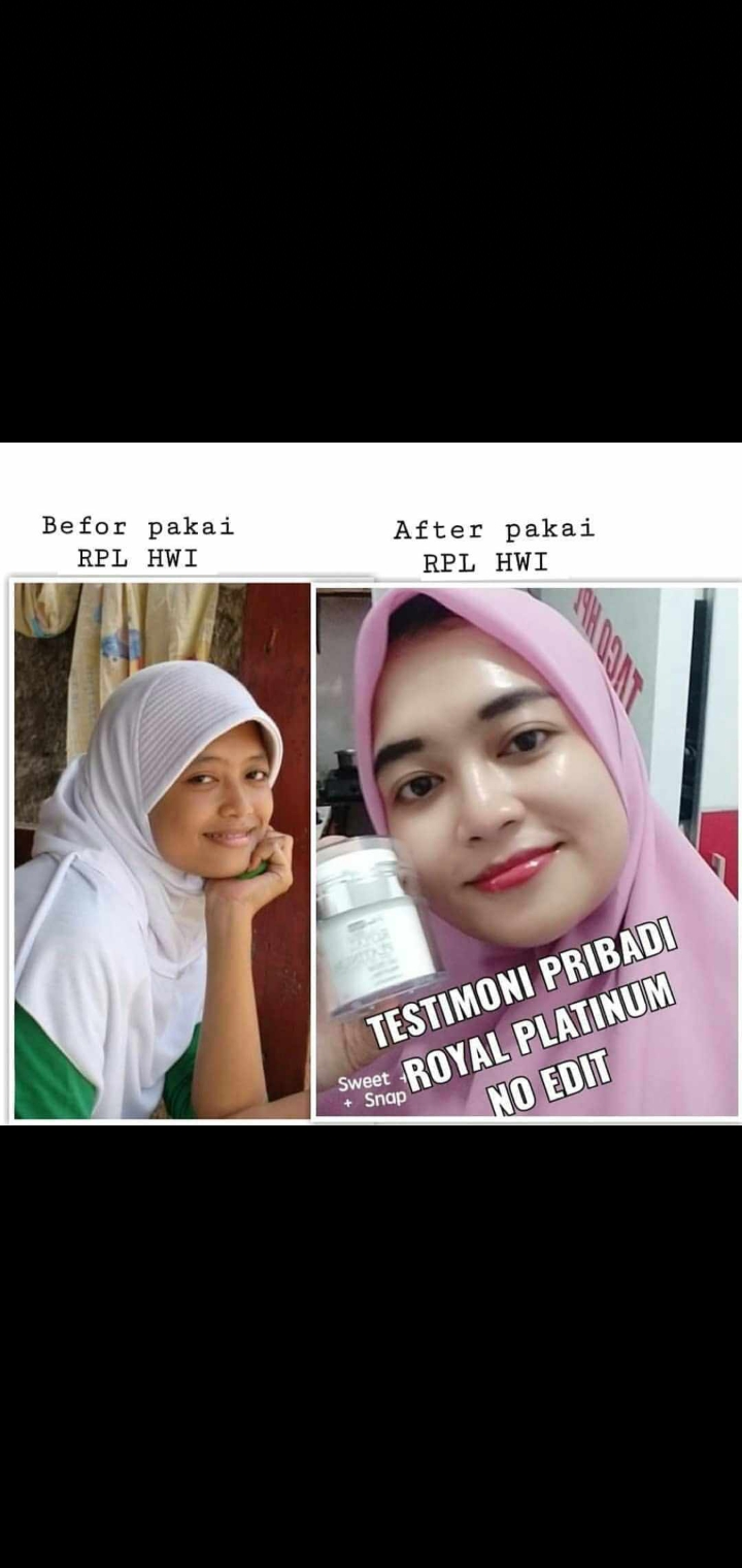 Prime Skin Royal Platinum Day cream&Night Cream 3