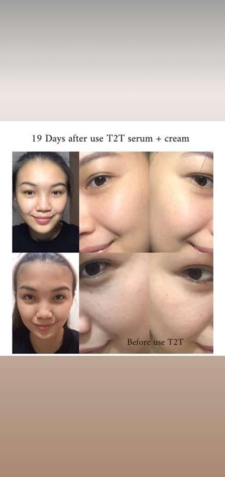 Prime Skin T2T serum & Cream 2