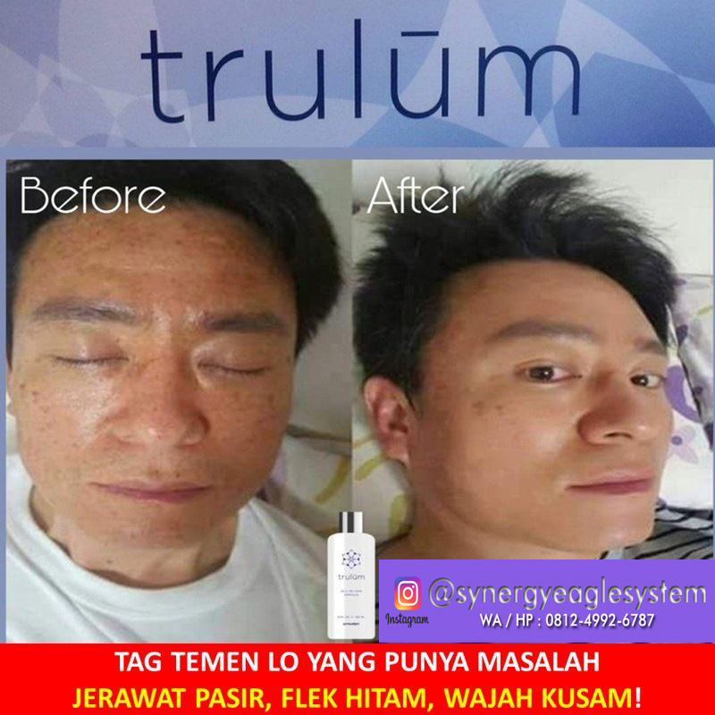 Synergy Trulum All-In-One Ampule Original Membuat Kulit Wajah Cerah 4