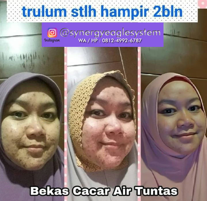 Synergy Trulum All-In-One Ampule Original Membuat Kulit Wajah Cerah 5