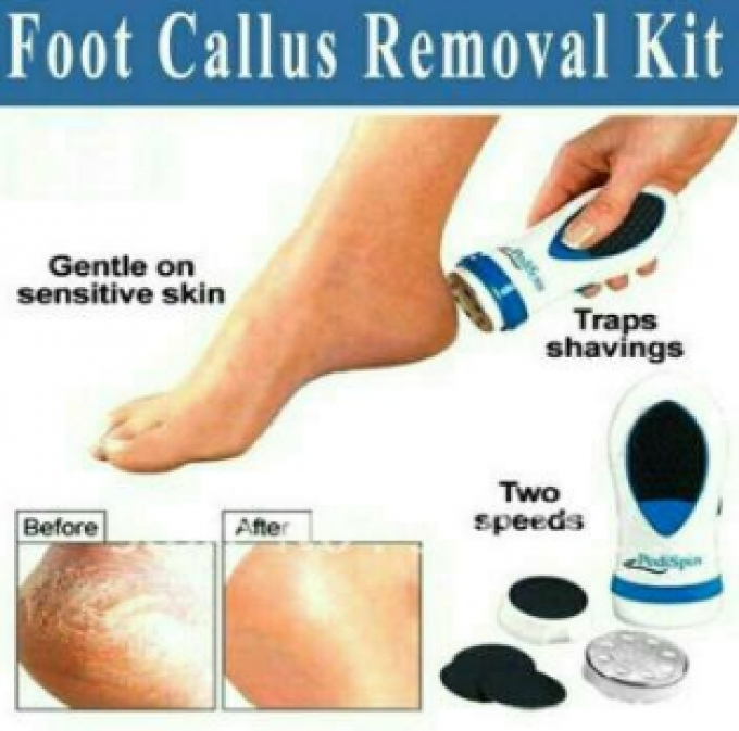 Penghalus Tumit Kaki Kasar