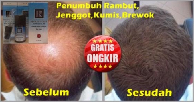 PENUMBUH RAMBUT JENGGOT