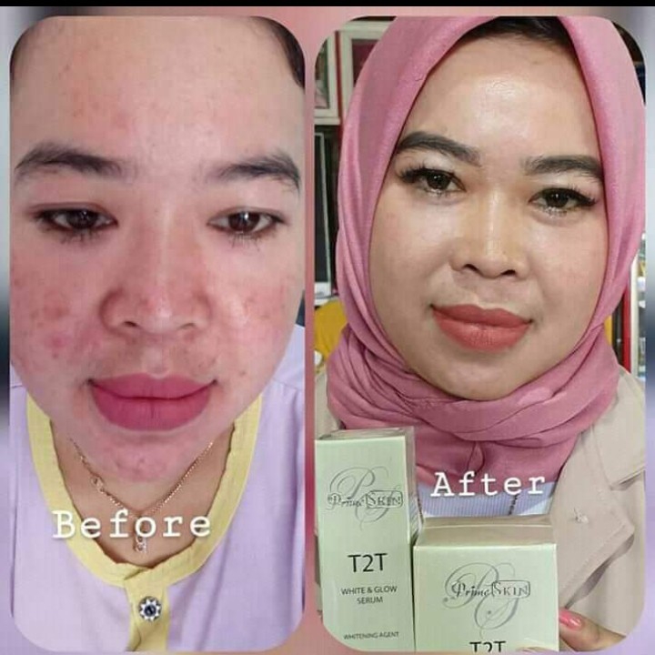 1 Paket Cream T2T 3