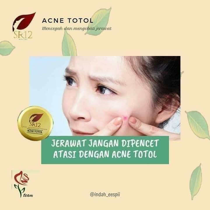 ACNE TOTOL