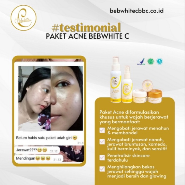 Acne Series Free Pouch Cantik Wrn Gold 3