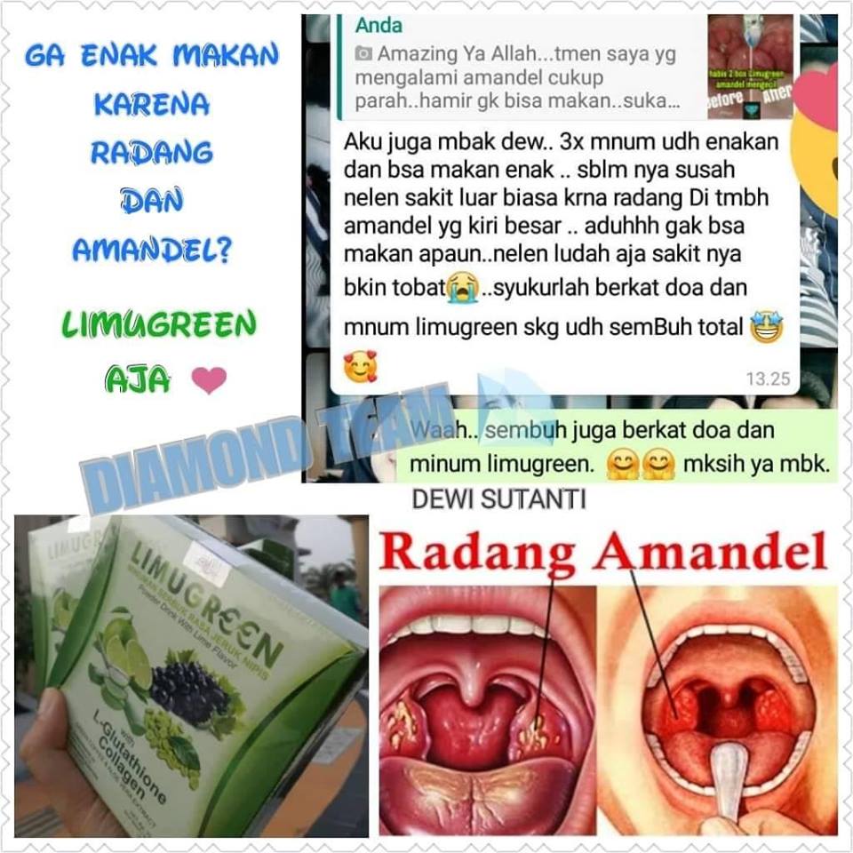 Amandel