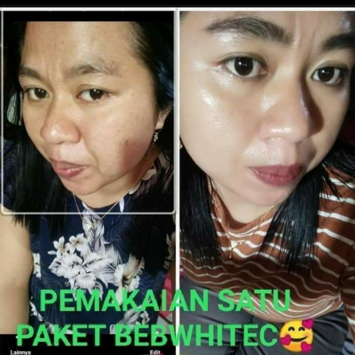 Bebwhite C Skincare 2