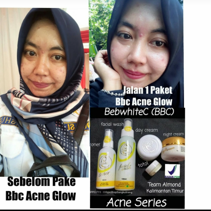 Bebwhite C Skincare 4