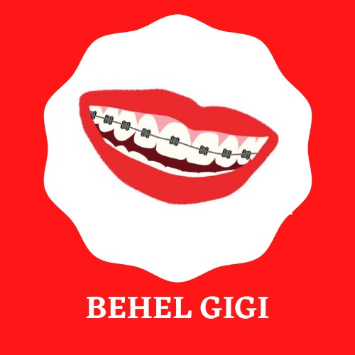 Behel Gigi Atas Bawah