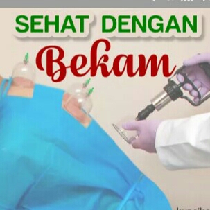 Bekam