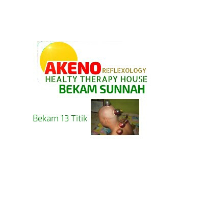 Bekam 13 Titik