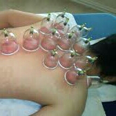 Bekam Kering