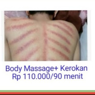 Body Massage kerokan