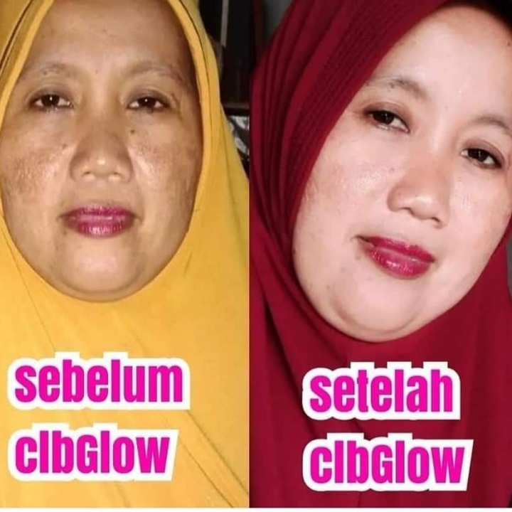 CLB GLOW Cream Whitening Original 4