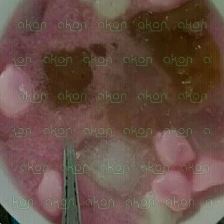 Dawet Campur Gempol