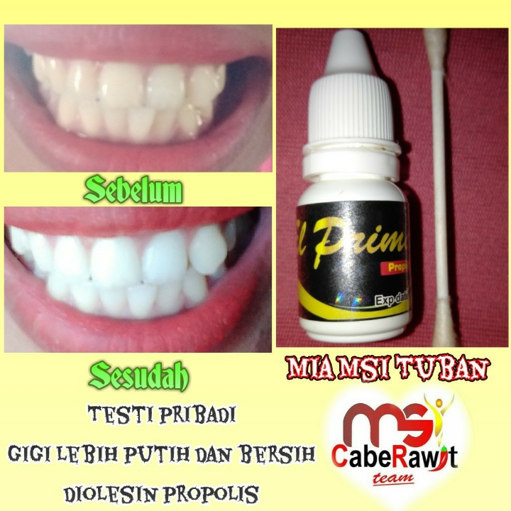 ELPRIMA PROPOLIS MSI