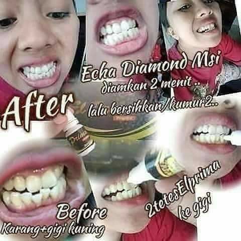 ELPRIMA PROPOLIS MSI 3