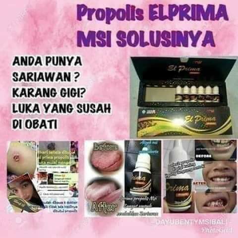 ELPRIMA PROPOLIS MSI 4