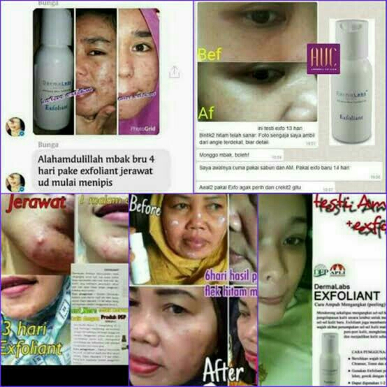 Exfoliant Dermalabs  4