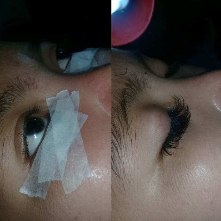 Eyelash extension