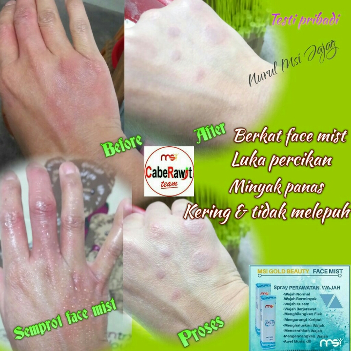 Face Mist