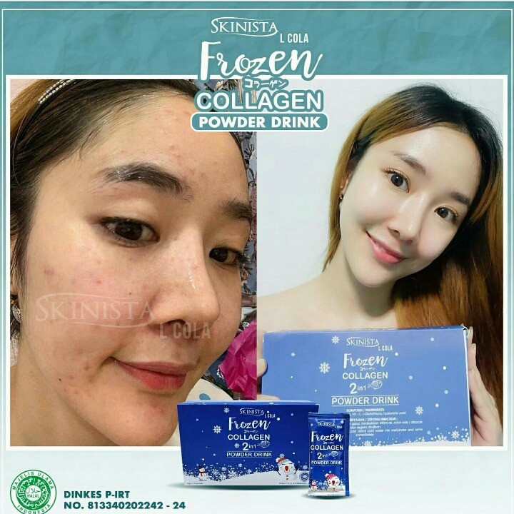 Frozen Collagen Skinista Box