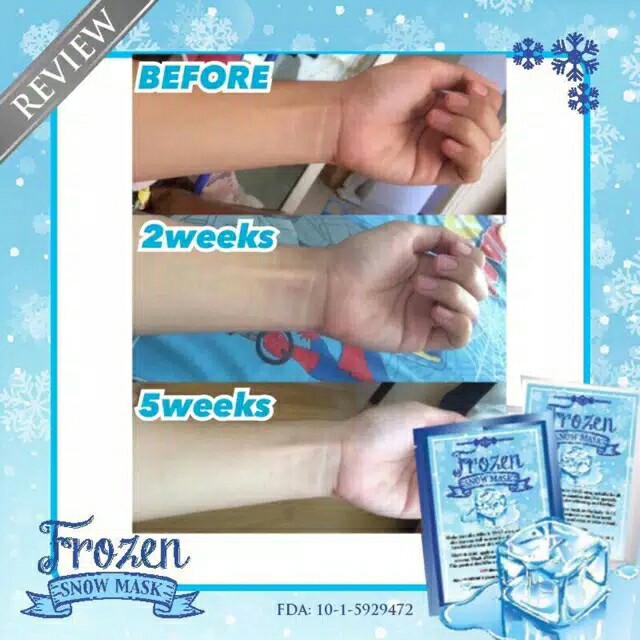 Frozen Snow Mask 4