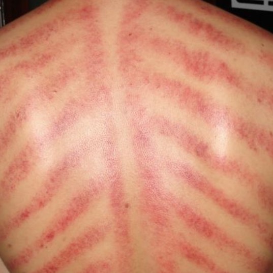 Full Body Massage Dan Kerokan 2
