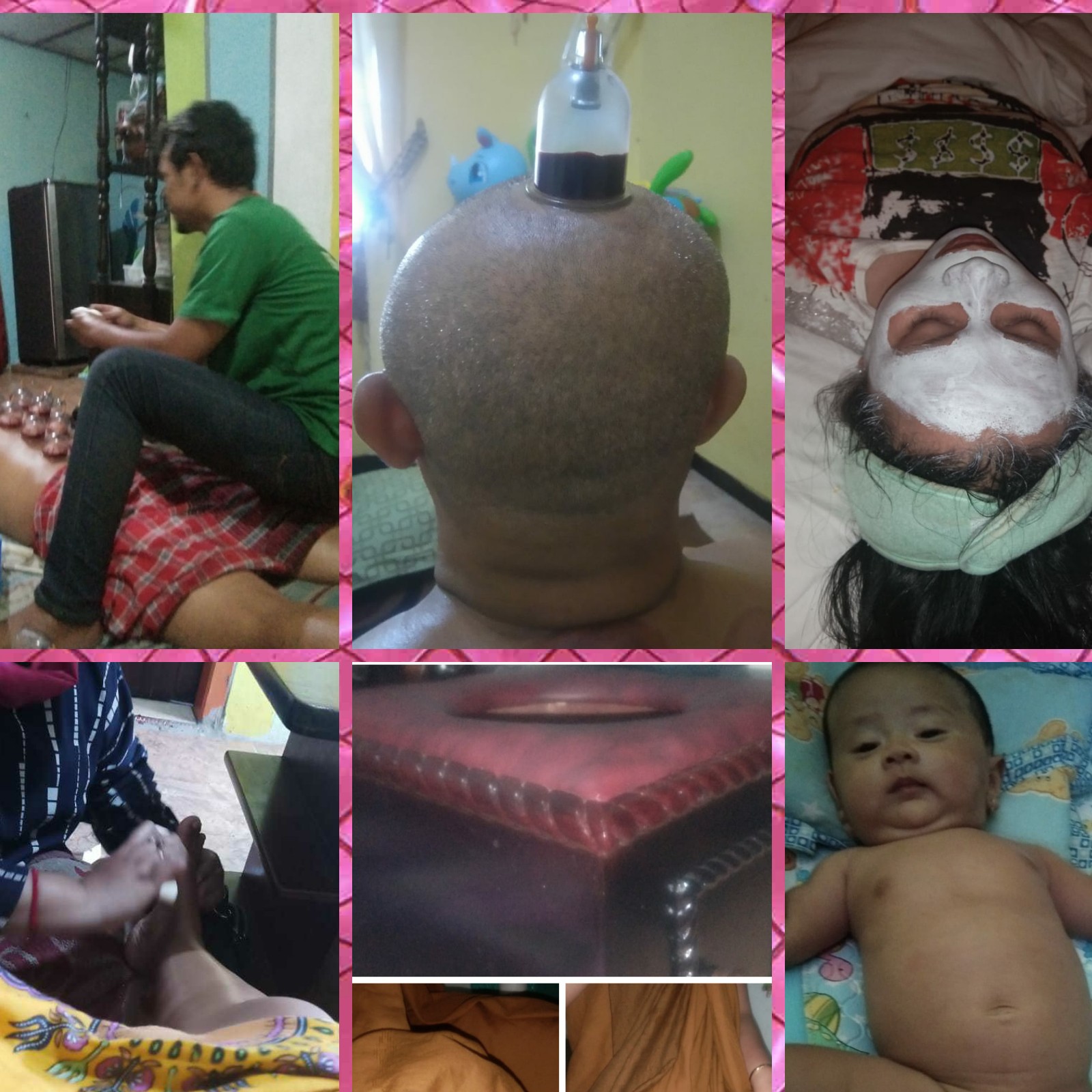 HARGA PAKET THREATMENT