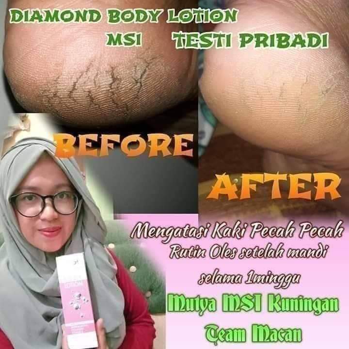 Handbody Lotion Diamond MSI