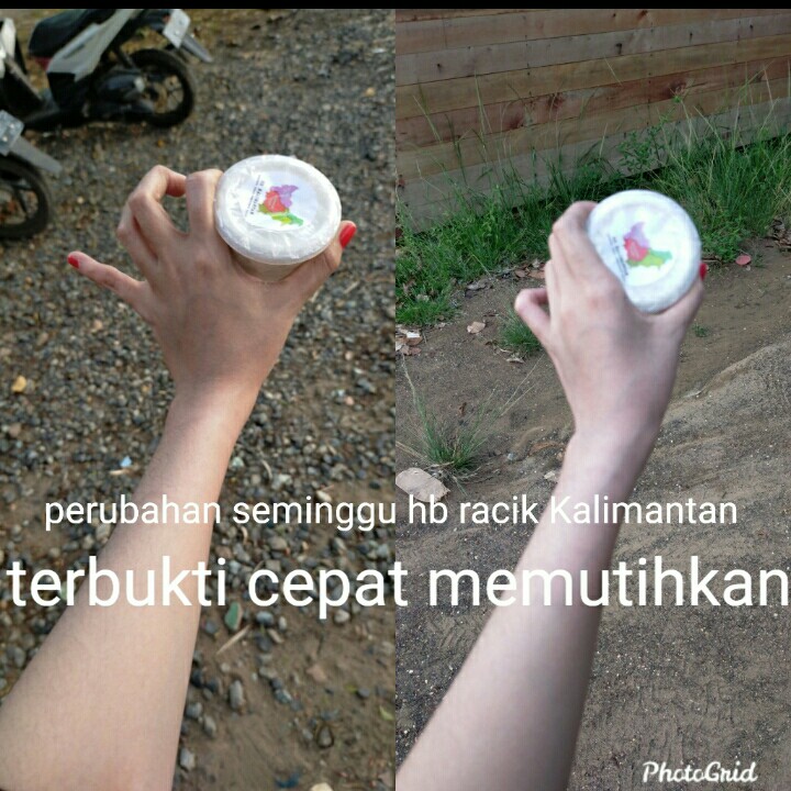 Hb Kalimantan Whitening