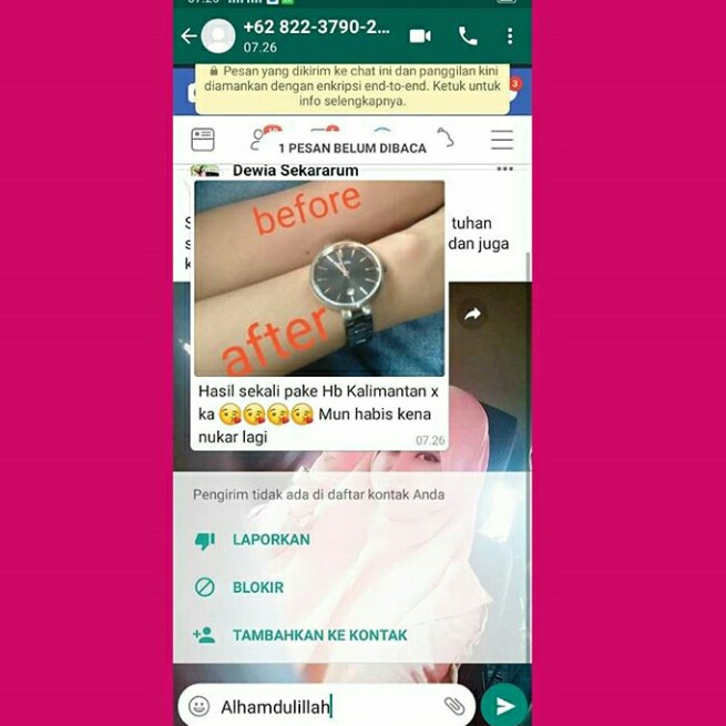 Hb Kalimantan Whitening 3