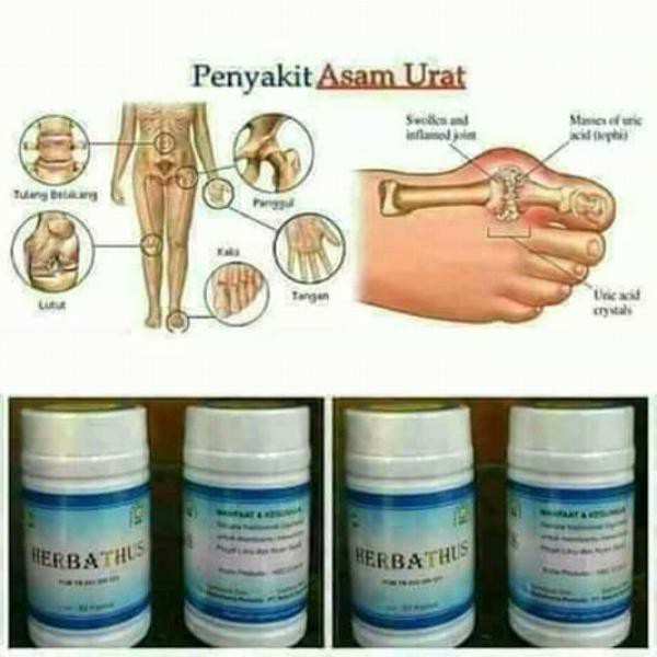 Herbatus 