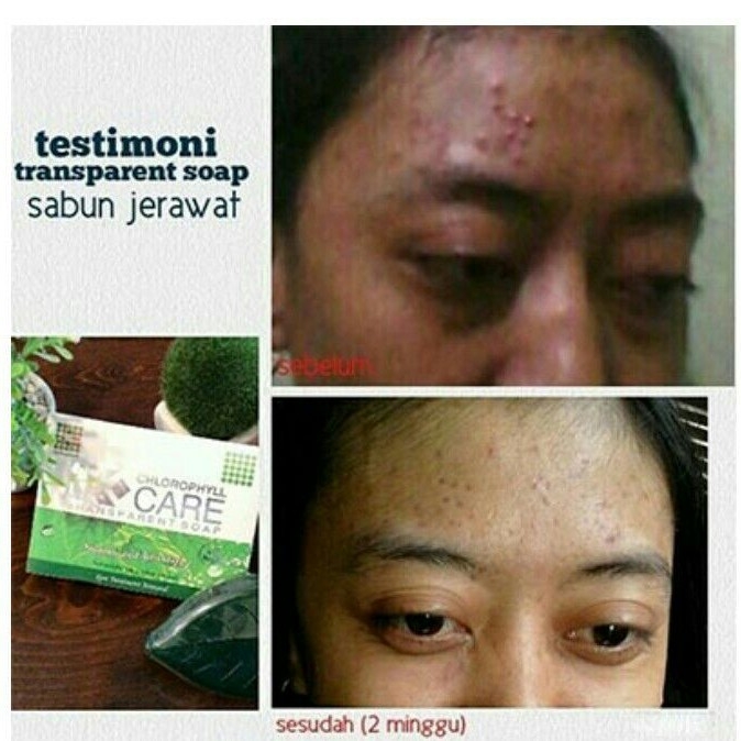 K-care Transparant Soap