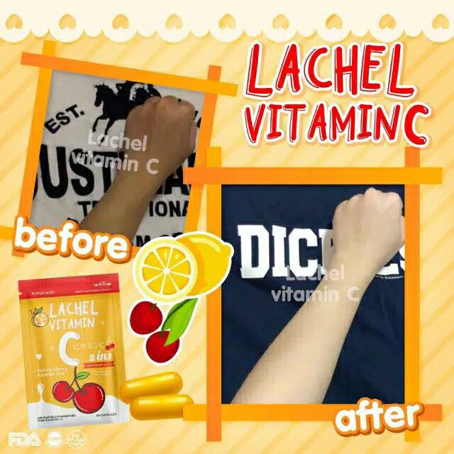 Lachel Vitamin C 3