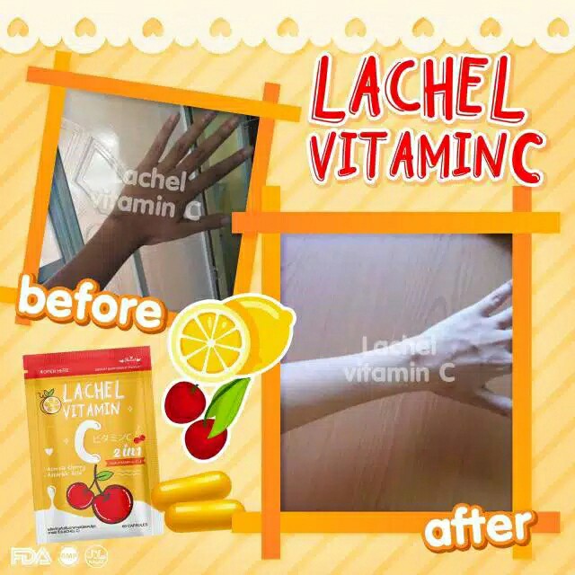 Lachel Vitamin C 4