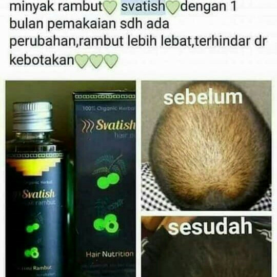 MINYAK RAMBUT SVATISH  3