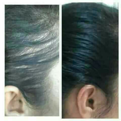 MINYAK RAMBUT SVATISH  4
