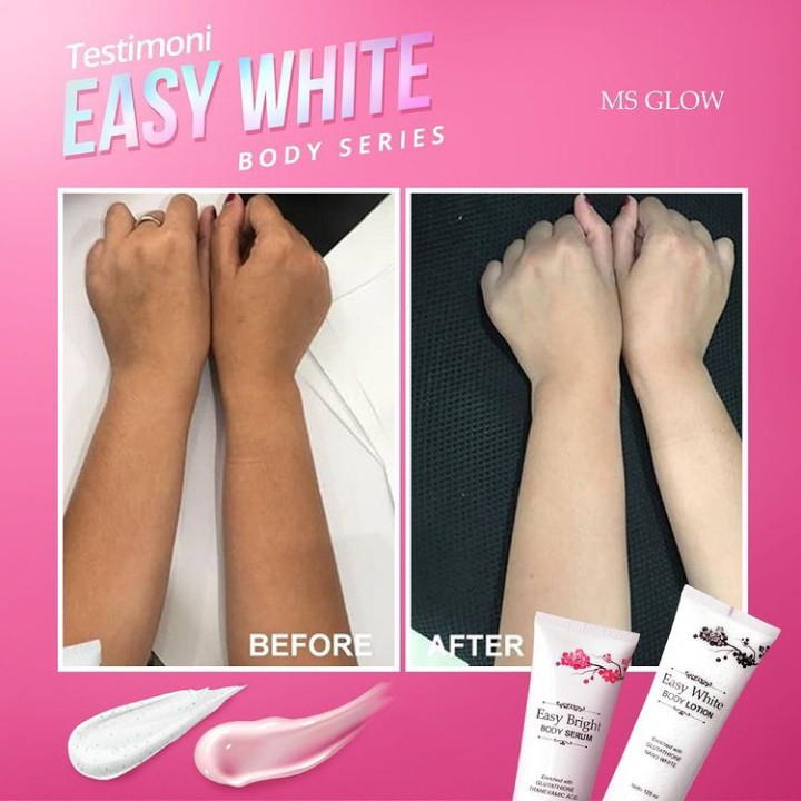 Ms Glow Easy White Body Series 2