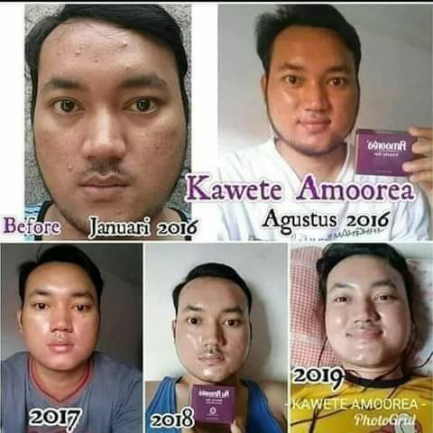 NU AMOOREA Beuty Plus Bar 3